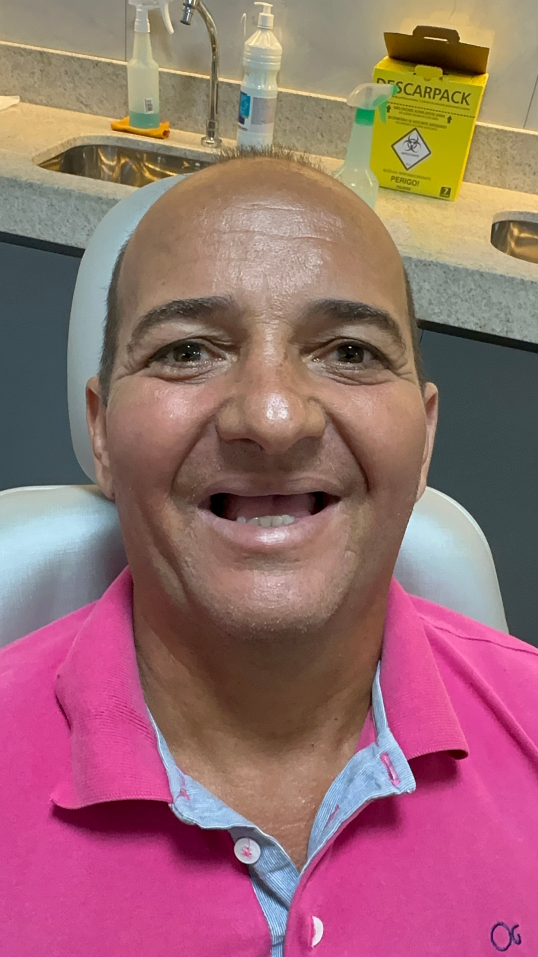 Antes do tratamento — Carlos M.