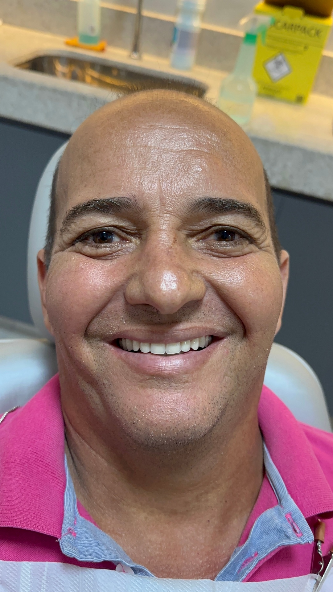 Depois do tratamento — Carlos M.