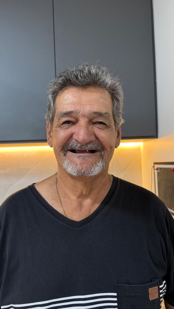 Antes do tratamento — Antônio R.